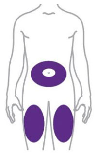 Välj injektionsställe